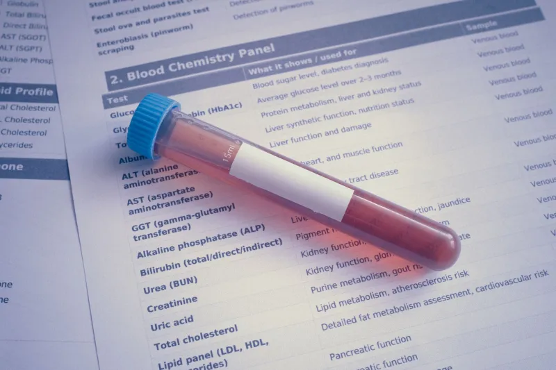 Your Labs Look Great. So Why Do You Still Feel Terrible? The Science Behind Amoxicillin's Hidden Timeline